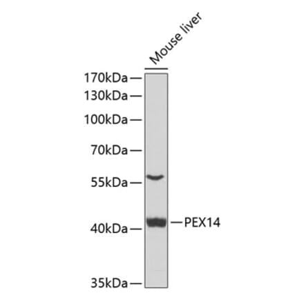 Western Blot - Anti-PEX14 Antibody (A15650) - Antibodies.com