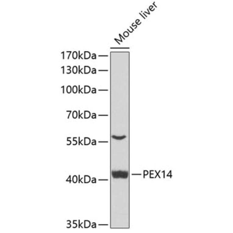 Western Blot - Anti-PEX14 Antibody (A15650) - Antibodies.com