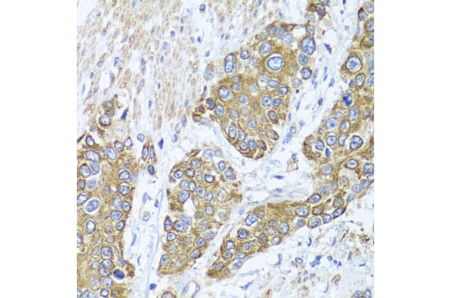 Immunohistochemistry - Anti-PEX14 Antibody (A15650) - Antibodies.com