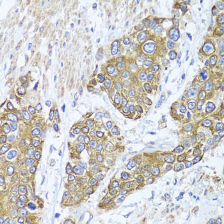 Immunohistochemistry - Anti-PEX14 Antibody (A15650) - Antibodies.com