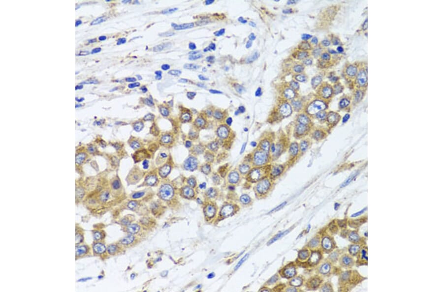 Immunohistochemistry - Anti-PEX14 Antibody (A15650) - Antibodies.com
