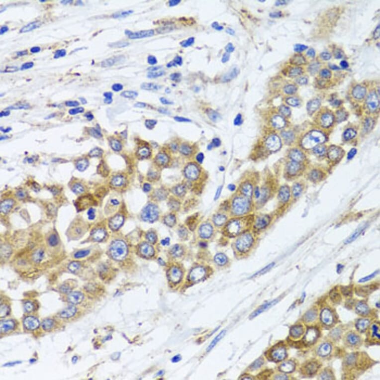 Immunohistochemistry - Anti-PEX14 Antibody (A15650) - Antibodies.com