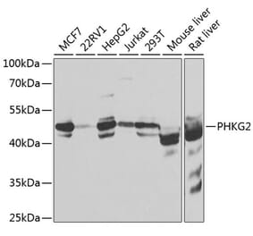 Western Blot - Anti-PHKG2 Antibody (A15651) - Antibodies.com