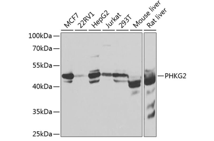 Western Blot - Anti-PHKG2 Antibody (A15651) - Antibodies.com