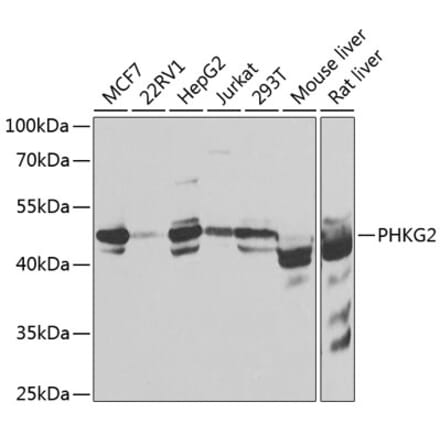 Western Blot - Anti-PHKG2 Antibody (A15651) - Antibodies.com