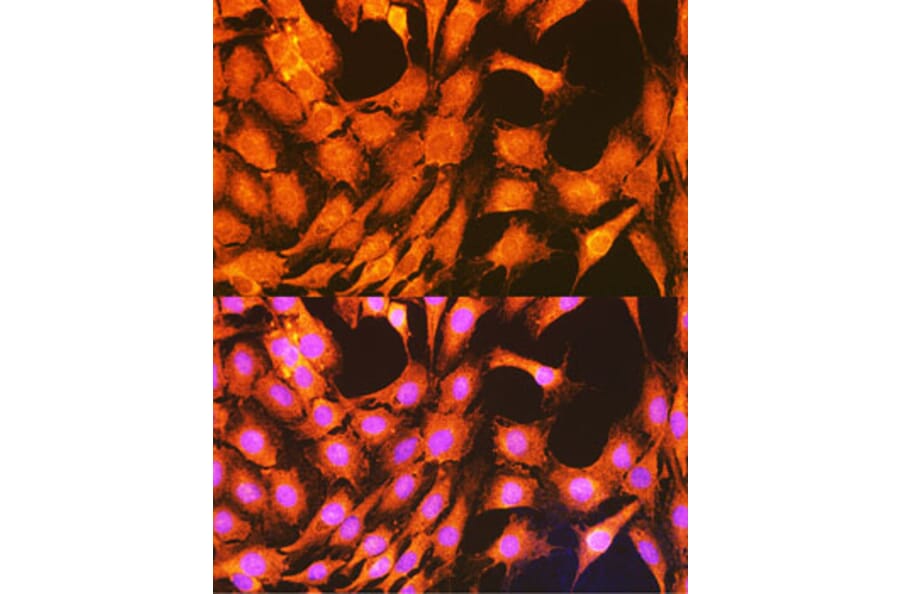 Immunofluorescence - Anti-PHKG2 Antibody (A15651) - Antibodies.com