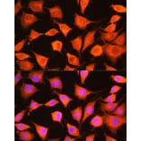 Immunofluorescence - Anti-PHKG2 Antibody (A15651) - Antibodies.com
