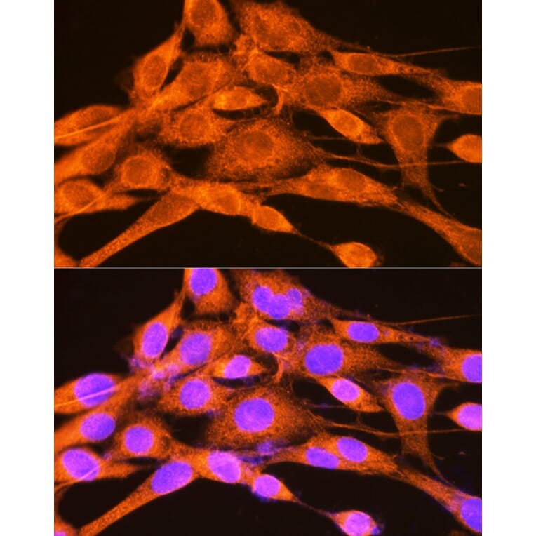 Immunofluorescence - Anti-PHKG2 Antibody (A15651) - Antibodies.com