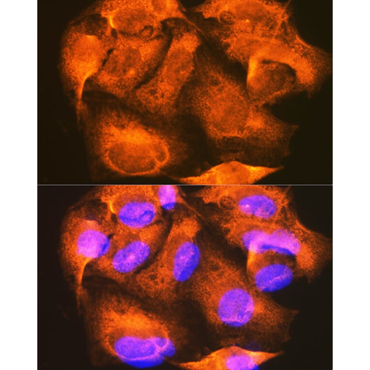 Immunofluorescence - Anti-PHKG2 Antibody (A15651) - Antibodies.com
