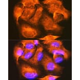 Immunofluorescence - Anti-PHKG2 Antibody (A15651) - Antibodies.com