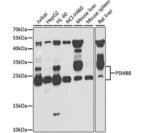 Western Blot - Anti-Proteasome 20S LMP7 Antibody (A15653) - Antibodies.com