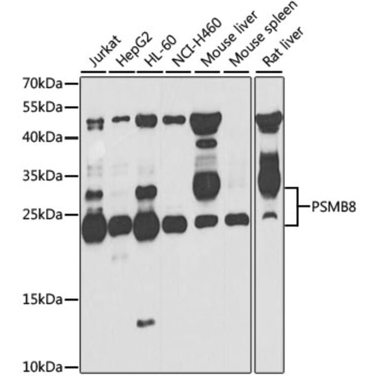 Western Blot - Anti-Proteasome 20S LMP7 Antibody (A15653) - Antibodies.com