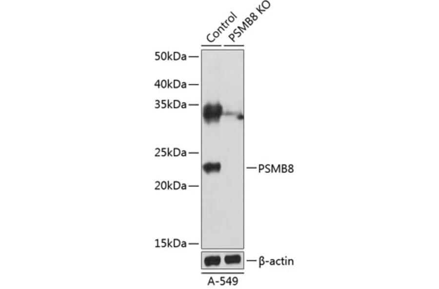 Western Blot - Anti-Proteasome 20S LMP7 Antibody (A15653) - Antibodies.com