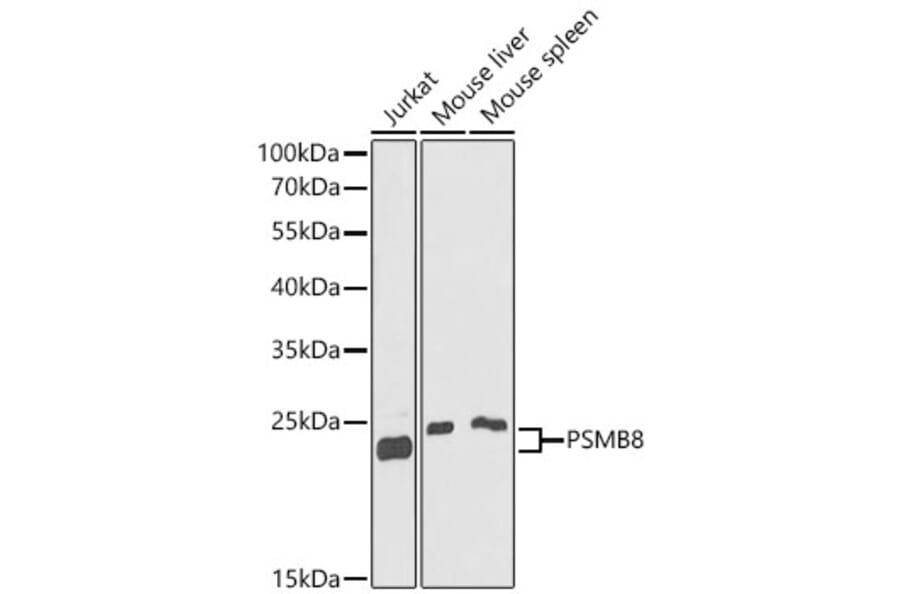 Western Blot - Anti-Proteasome 20S LMP7 Antibody (A15653) - Antibodies.com
