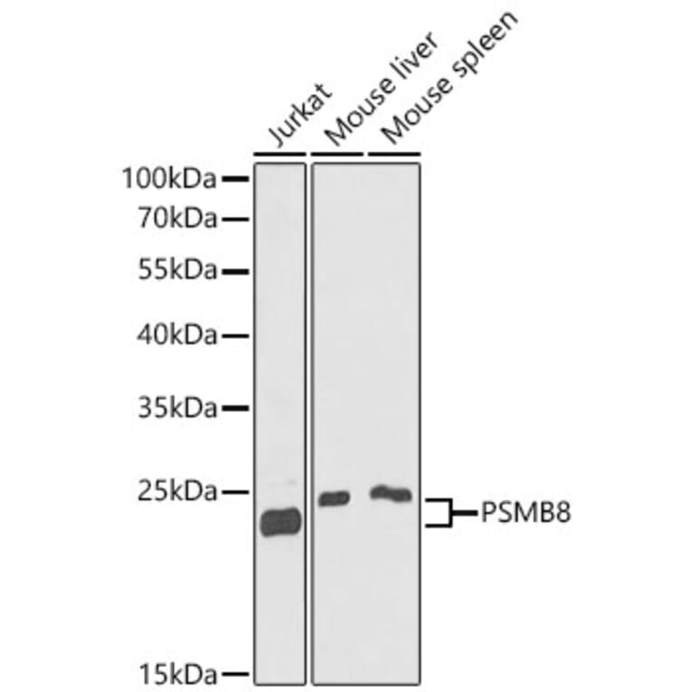 Western Blot - Anti-Proteasome 20S LMP7 Antibody (A15653) - Antibodies.com