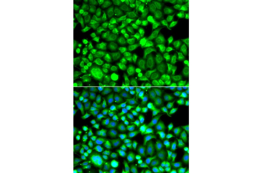 Immunofluorescence - Anti-Proteasome 20S LMP7 Antibody (A15653) - Antibodies.com
