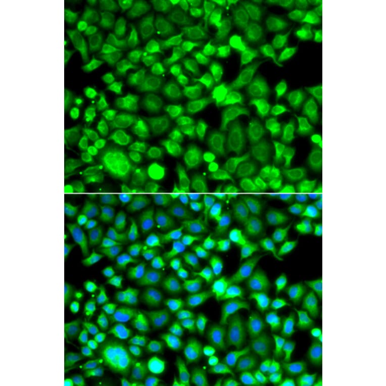 Immunofluorescence - Anti-Proteasome 20S LMP7 Antibody (A15653) - Antibodies.com