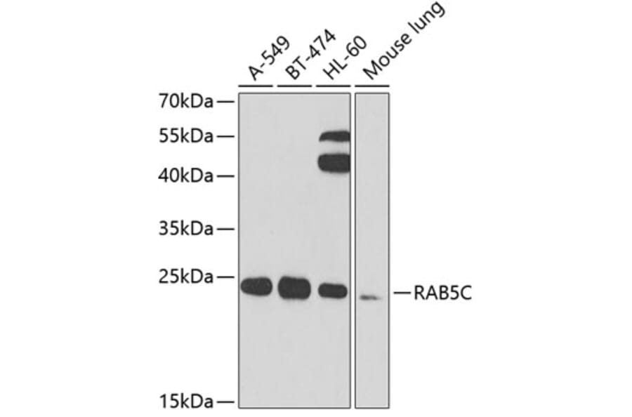 Western Blot - Anti-RAB5C/RABL Antibody (A15655) - Antibodies.com