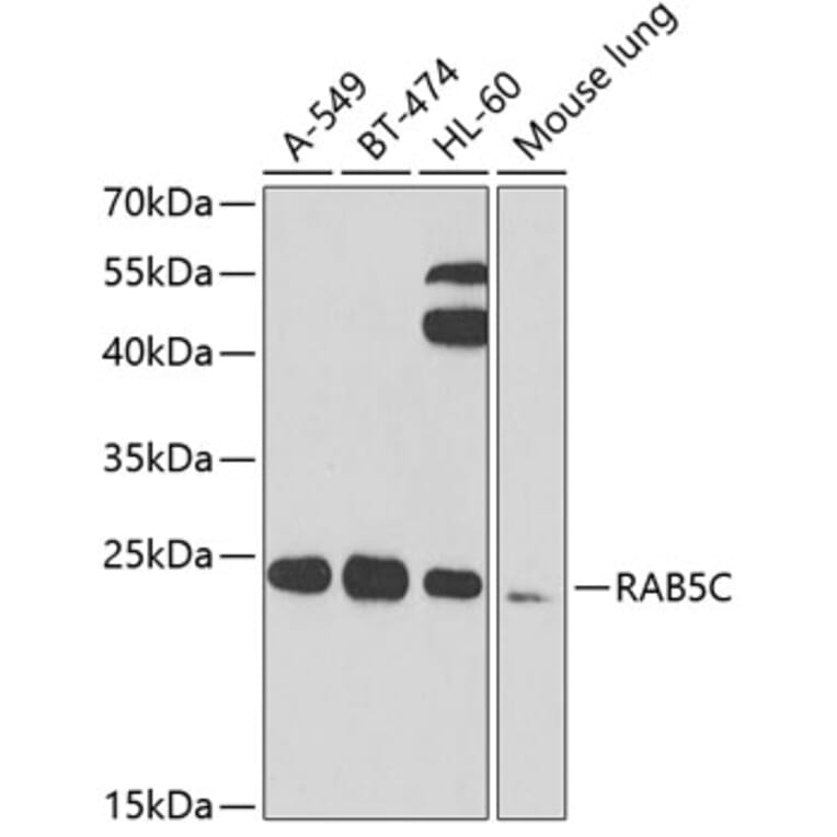 Western Blot - Anti-RAB5C/RABL Antibody (A15655) - Antibodies.com