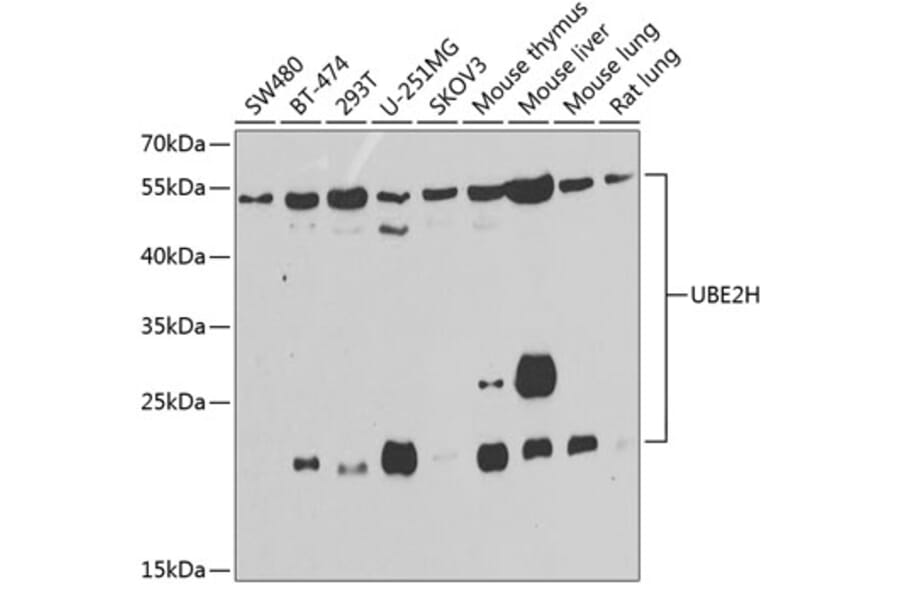 Western Blot - Anti-Ube2H Antibody (A15656) - Antibodies.com