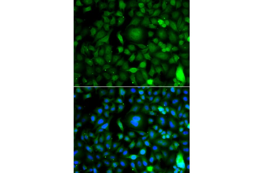 Immunofluorescence - Anti-DPF1 Antibody (A7349) - Antibodies.com