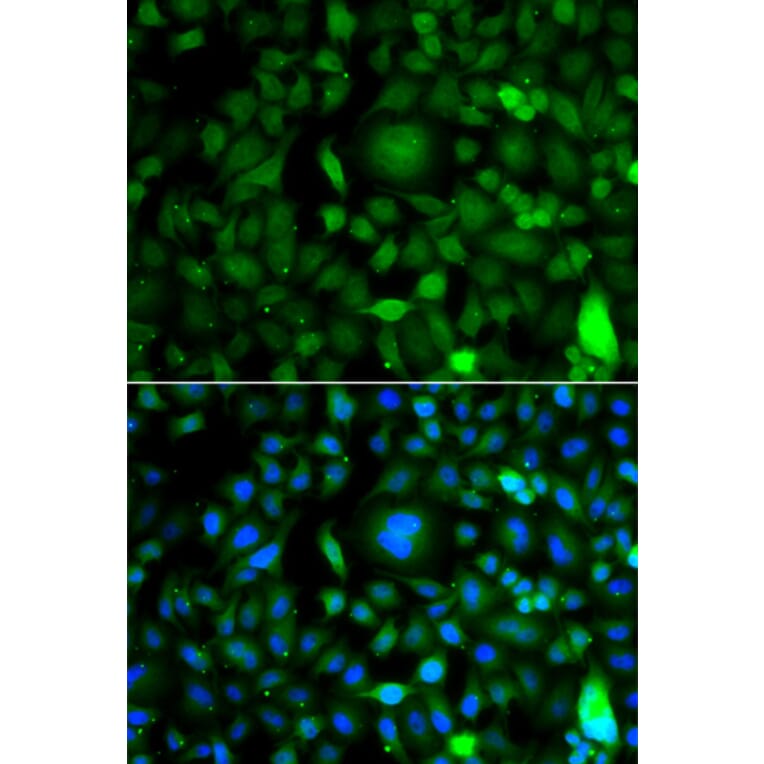 Immunofluorescence - Anti-DPF1 Antibody (A7349) - Antibodies.com