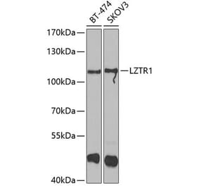 Western Blot - Anti-LZTR1 Antibody (A15658) - Antibodies.com