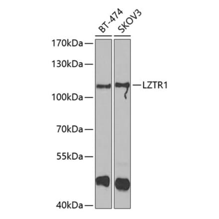 Western Blot - Anti-LZTR1 Antibody (A15658) - Antibodies.com