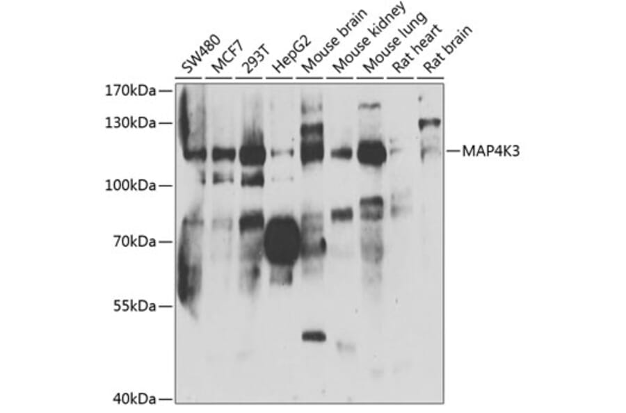 Western Blot - Anti-MAP4K3/GLK Antibody (A15659) - Antibodies.com
