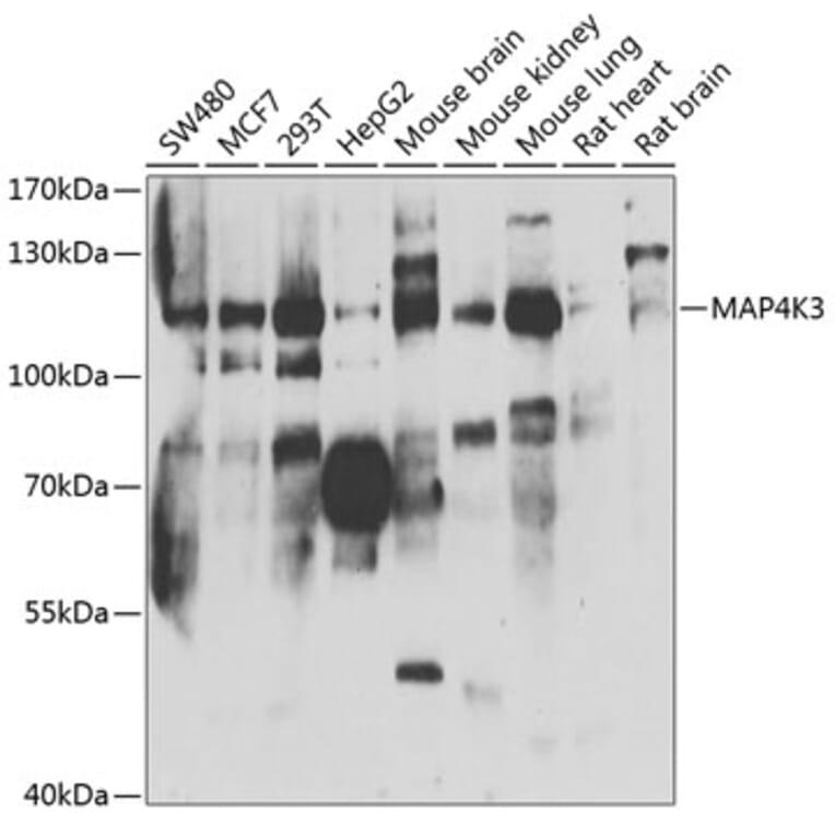 Western Blot - Anti-MAP4K3/GLK Antibody (A15659) - Antibodies.com