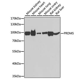 Western Blot - Anti-PRDM5 Antibody (A15663) - Antibodies.com
