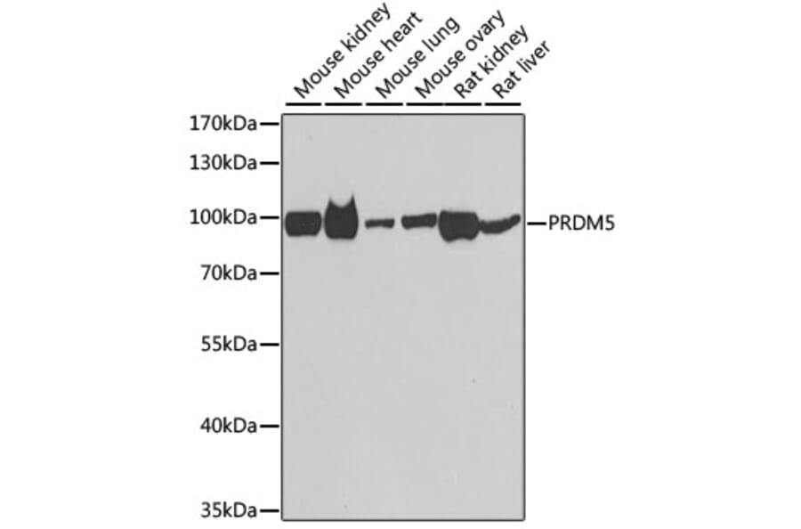 Western Blot - Anti-PRDM5 Antibody (A15663) - Antibodies.com
