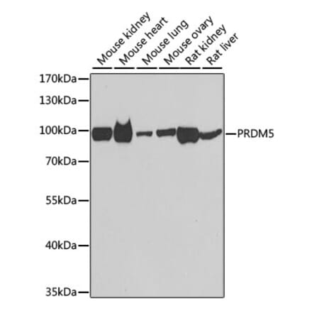 Western Blot - Anti-PRDM5 Antibody (A15663) - Antibodies.com