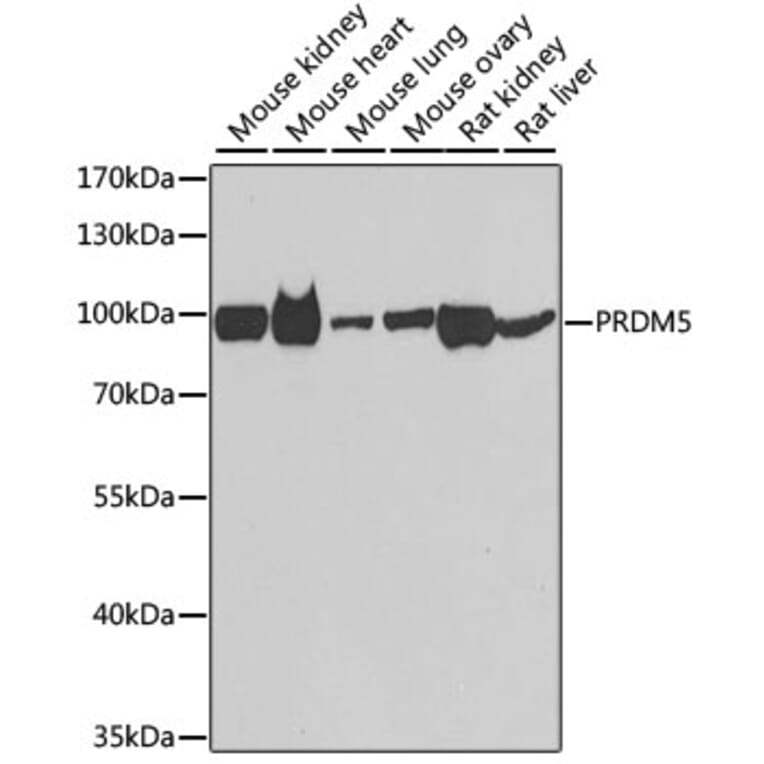 Western Blot - Anti-PRDM5 Antibody (A15663) - Antibodies.com
