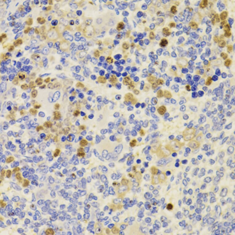 Immunohistochemistry - Anti-PRDM5 Antibody (A15663) - Antibodies.com