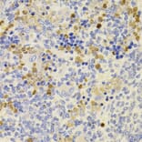 Immunohistochemistry - Anti-PRDM5 Antibody (A15663) - Antibodies.com
