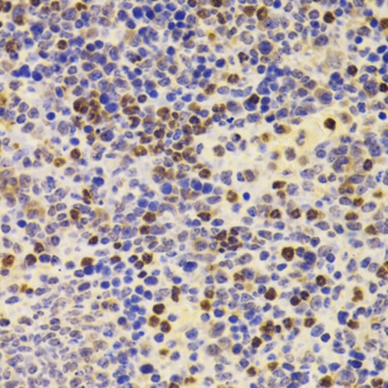 Immunohistochemistry - Anti-PRDM5 Antibody (A15663) - Antibodies.com