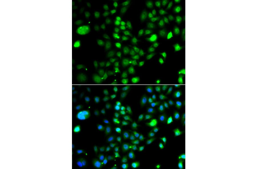 Immunofluorescence - Anti-PRDM5 Antibody (A15663) - Antibodies.com