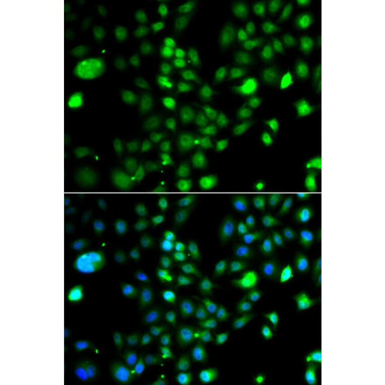 Immunofluorescence - Anti-PRDM5 Antibody (A15663) - Antibodies.com