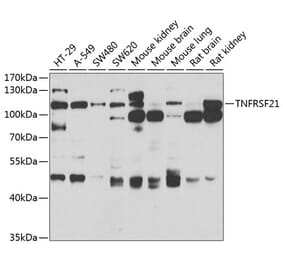 Western Blot - Anti-DR6 Antibody (A15665) - Antibodies.com