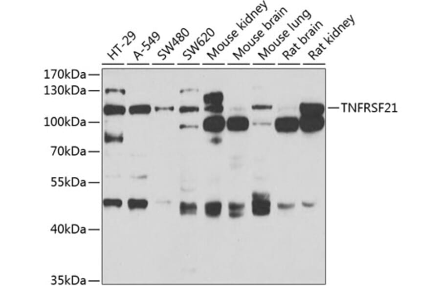 Western Blot - Anti-DR6 Antibody (A15665) - Antibodies.com