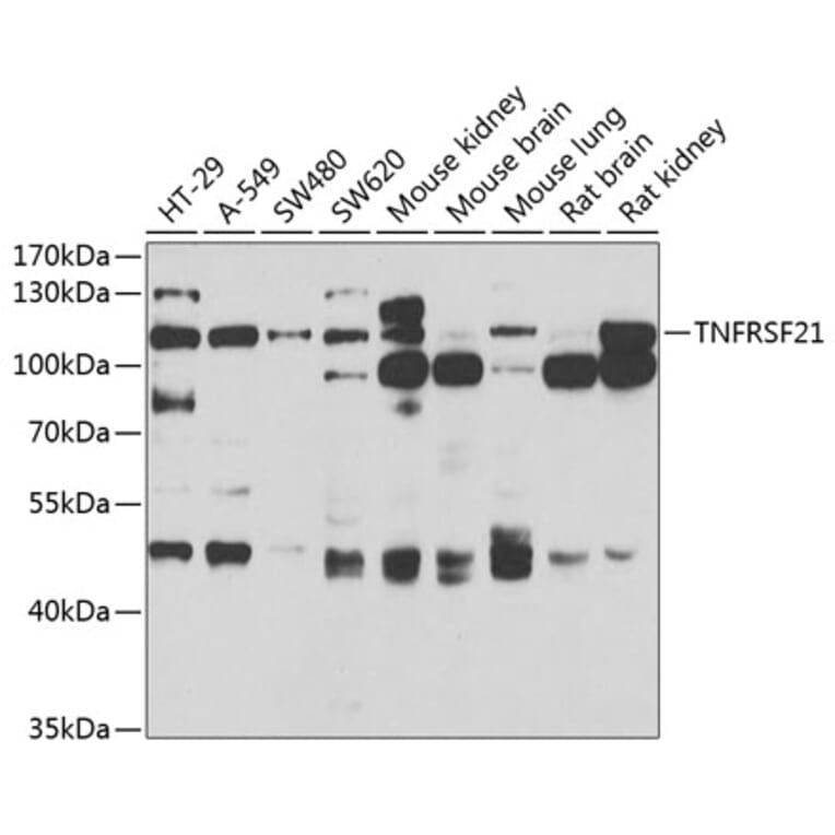 Western Blot - Anti-DR6 Antibody (A15665) - Antibodies.com