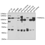 Western Blot - Anti-DR6 Antibody (A15665) - Antibodies.com