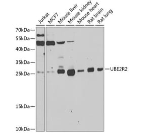 Western Blot - Anti-UBC3B Antibody (A15667) - Antibodies.com