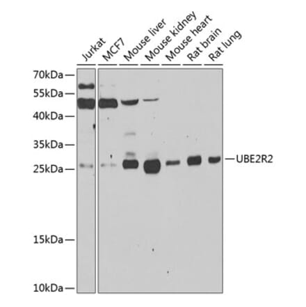 Western Blot - Anti-UBC3B Antibody (A15667) - Antibodies.com