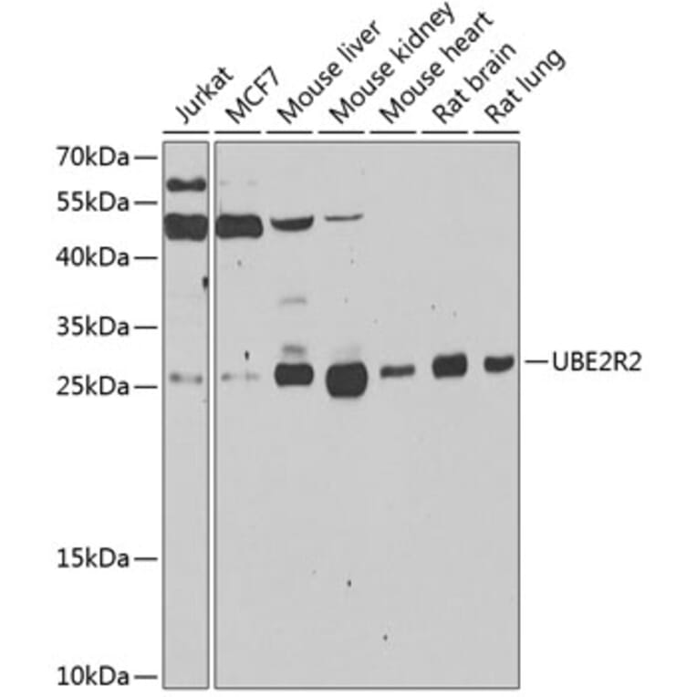 Western Blot - Anti-UBC3B Antibody (A15667) - Antibodies.com