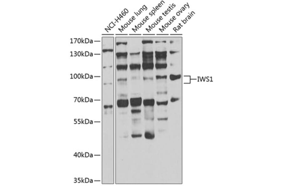 Western Blot - Anti-IWS1 Antibody (A7375) - Antibodies.com