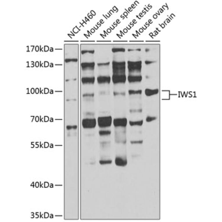 Western Blot - Anti-IWS1 Antibody (A7375) - Antibodies.com