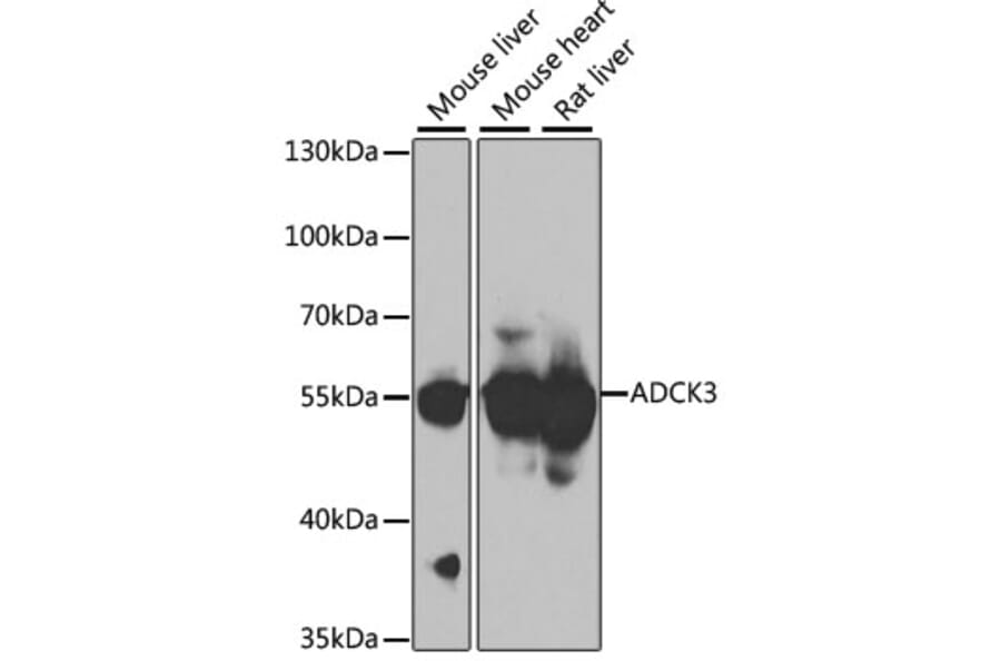 Western Blot - Anti-ADCK3 Antibody (A7378) - Antibodies.com