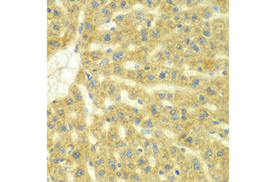 Immunohistochemistry - Anti-ADCK3 Antibody (A7378) - Antibodies.com